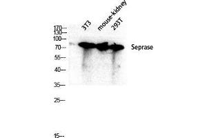 Western Blot (WB) analysis of 3T3 Mouse Kidney 293T lysis using Seprase antibody. (FAP Antikörper  (Internal Region))