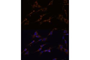 Immunofluorescence analysis of C6 cells using RPL7A Polyclonal Antibody (ABIN6128657, ABIN6147150, ABIN6147152 and ABIN6217809) at dilution of 1:100 (40x lens).