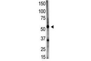 Image no. 1 for anti-Growth Differentiation Factor 5 (GDF5) (N-Term) antibody (ABIN357461) (GDF5 Antikörper  (N-Term))