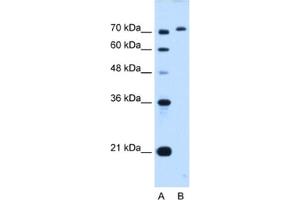 Western Blotting (WB) image for anti-GPI Anchor Attachment Protein 1 (GPAA1) antibody (ABIN2462976) (GPAA1 Antikörper)