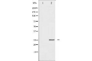 Western blot analysis of p21 Cip1 expression in EGF treated HeLa whole cell lysates,The lane on the left is treated with the antigen-specific peptide. (p21 Antikörper  (C-Term))