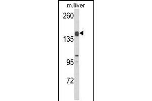 Western blot analysis of ADAMTS18 Antibody in mouse liver tissue lysates (35ug/lane)