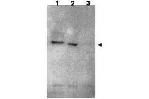 Western blot using  affinity purified anti-RNF25 antibody shows detection of RNF25 (arrow head) in HEK293 cells over-expressing human RNF25 (lane 1) or mouse RNF25 (lane 2). (RNF25 Antikörper  (C-Term))