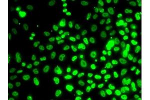 Immunofluorescence analysis of MCF7 cells using RP antibody (ABIN6128655, ABIN6147086, ABIN6147088 and ABIN6222439). (RPA3 Antikörper  (AA 6-121))
