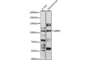 Western blot analysis of extracts of various cell lines, using GRIK5 antibody (ABIN7267416) at 1:1000 dilution. (GRIK5 Antikörper  (AA 350-420))