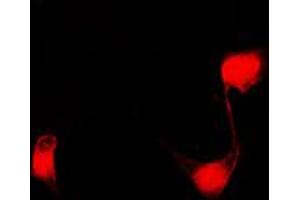 Immunofluorescent analysis of PPHLN1 staining in COLO205 cells. (PPHLN1 Antikörper  (Center))