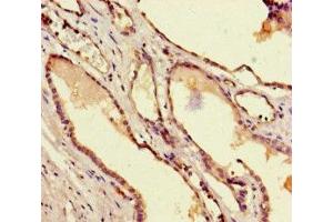 Immunohistochemistry (IHC) image for anti-TAF6 RNA Polymerase II, TATA Box Binding Protein (TBP)-Associated Factor, 80kDa (TAF6) (AA 627-677) antibody (ABIN7172691)