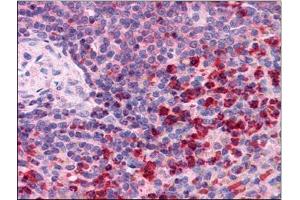 Immunohistochemistry Image: Human Spleen: Formalin-Fixed, Paraffin-Embedded (FFPE) (TXNRD1 Antikörper  (C-Term))