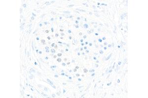 anti-Transcription Factor MafA (MAFA) (AA 125-175) antibody