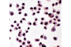 Anti-Nucleophosmin antibody, ICC ICC: HELA Cell (NPM1 Antikörper  (N-Term))