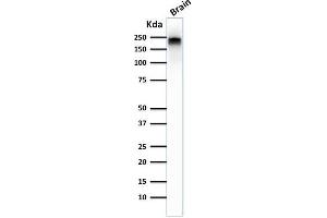 Western Blot Analysis of human Brain tissue lysate using Neurofilament Mouse Monoclonal Antibody (NE14). (NEFH Antikörper)