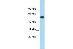 WB Suggested Anti-PIP5K1B Antibody Titration: 1.