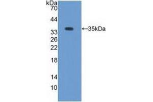 Western blot analysis of recombinant Rabbit PKCb1.