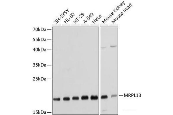 MRPL13 anticorps