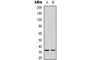 Western blot analysis of FOXE3 expression in SHSYSY (A), MDAMB435 (B) whole cell lysates.
