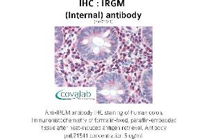 Image no. 1 for anti-Immunity-Related GTPase Family, M (IRGM) (Internal Region) antibody (ABIN1736037)