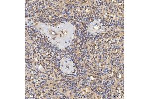 IHC analysis of SNF2H/SMARCA5 using anti-SNF2H/SMARCA5 antibody (ABIN7602001).