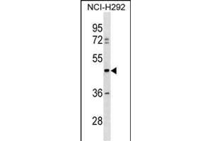 TULP3 Antibody (C-term) (ABIN1537220 and ABIN2850401) western blot analysis in NCI- cell line lysates (35 μg/lane). (TULP3 Antikörper  (C-Term))