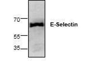 Image no. 1 for anti-Selectin E (SELE) antibody (ABIN127258) (Selectin E/CD62e Antikörper)