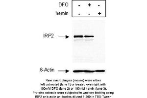 Image no. 1 for anti-Iron-Responsive Element Binding Protein 2 (IREB2) antibody (ABIN363497)