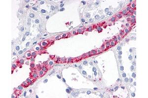 Anti-ADAMTS4 antibody IHC of human kidney.