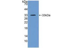 Detection of Recombinant ITIH4, Human using Polyclonal Antibody to Inter Alpha-Globulin Inhibitor H4 (ITIH4) (ITIH4 Antikörper  (AA 683-928))