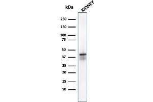 Western Blot analysis of Kidney tissue lysate using AMACR Mouse Monoclonal Antibody (AMACR/1723). (AMACR Antikörper)