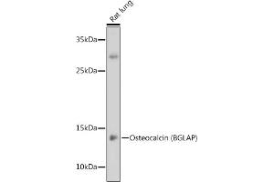 Western blot analysis of extracts of Rat lung, using Osteocalcin (BGLAP) antibody (ABIN6134565, ABIN6137546, ABIN6137547 and ABIN6221793) at 1:1000 dilution. (Osteocalcin Antikörper  (AA 1-100))