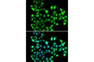 Immunofluorescence analysis of MCF-7 cells using SNRPD2 antibody.