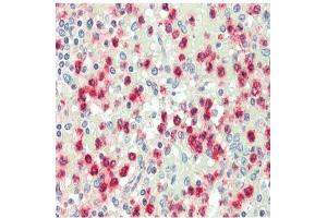 Immunohistochemistry analysis of Cathepsin G Antibody in paraffin-embedded human spleen tissue at 1/100. (Cathepsin G Antikörper)