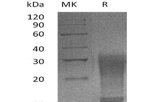 Western Blotting (WB) image for Interleukin 13 (IL13) (AA 26-131) (Active) protein (His tag) (ABIN7320576)
