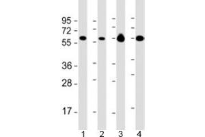 Western blot testing of 1) Daudi, 2) HL-60 cell lysate, 3) human brain and 4) mouse brain lysate with PACSIN2 antibody at 1:2000.