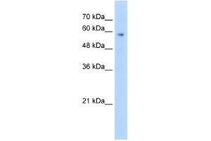WB Suggested Anti-TPTE Antibody Titration:  2. (TPTE Antikörper  (C-Term))