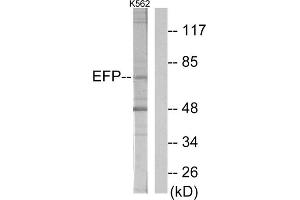 Western blot analysis of extracts from K562 cells, using ZNF147 antibody. (TRIM25 Antikörper  (Internal Region))