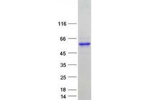 Validation with Western Blot (PPP1R3G Protein (Myc-DYKDDDDK Tag))