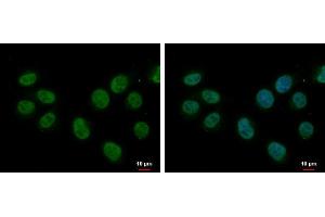 ICC/IF Image splicing factor 1 antibody [N1N3] detects splicing factor 1 protein at nucleus by immunofluorescent analysis. (Splicing Factor 1 Antikörper)