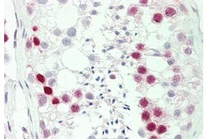 Rabbit Anti-HIST1H1C antibody  Formalin Fixed Paraffin Embedded Tissue: Human Testis Primary antibody Concentration: 1:100 Secondary Antibody: Donkey anti-Rabbit-Cy3 Secondary Antibody Concentration: 1:200 Magnification: 20x Exposure Time: 0.