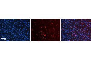 Rabbit Anti-OSBPL8 Antibody   Formalin Fixed Paraffin Embedded Tissue: Human Liver Tissue Observed Staining: Cytoplasm and plasma membrane in Kupffer cells and sinusoids Primary Antibody Concentration: 1:100 Other Working Concentrations: 1:600 Secondary Antibody: Donkey anti-Rabbit-Cy3 Secondary Antibody Concentration: 1:200 Magnification: 20X Exposure Time: 0. (OSBPL8 Antikörper  (N-Term))