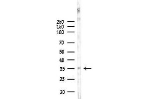 anti-Hydroxysteroid (17-Beta) Dehydrogenase 1 (HSD17B1) (C-Term) antibody