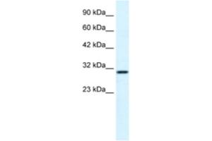 Western Blotting (WB) image for anti-FLJ20729 antibody (ABIN2460993) (FLJ20729 Antikörper)