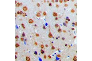 Immunohistochemical analysis of AKAP13 staining in human brain formalin fixed paraffin embedded tissue section. (AKAP13 Antikörper  (Center))