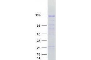 Validation with Western Blot