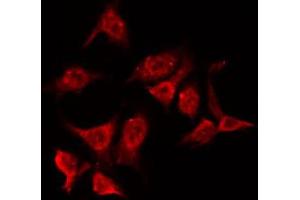 ABIN6266787 staining HeLa by IF/ICC. (NPM1 Antikörper  (N-Term))