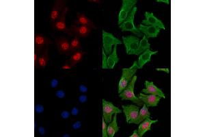 ABIN7093538 and ABIN7097562 staining Hela cells by IF/ICC. (RPA2 Antikörper)
