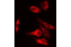 ABIN6275667 staining  COLO205 cells by IF/ICC. (UGDH Antikörper  (C-Term))