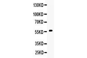Western blot analysis of CYP17A1 expression in 22RV1 whole cell lysates ( Lane 1). (CYP17A1 Antikörper  (C-Term))
