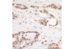 Immunohistochemistry (IHC) image for anti-Damage Specific DNA Binding Protein 1 (DDB1) (C-Term) antibody (ABIN7454634)