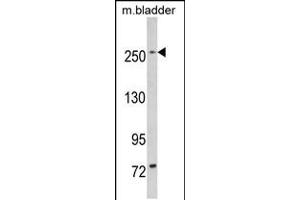 Western blot analysis of LRRK1 in mouse bladder tissue lysates (35ug/lane) (LRRK1 Antikörper  (C-Term))