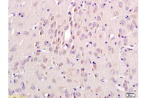 Formalin-fixed and paraffin embedded rat brain labeled with Rabbit Anti Annexin A13 Polyclonal Antibody, Unconjugated (ABIN735323) at 1:200 followed by conjugation to the secondary antibody and DAB staining (MSH alpha (AA 138-150) Antikörper)
