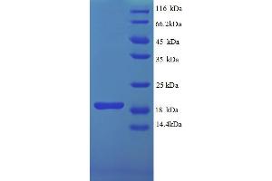 SDS-PAGE (SDS) image for Interferon gamma (IFNG) (AA 27-155) protein (His tag) (ABIN5712986)
